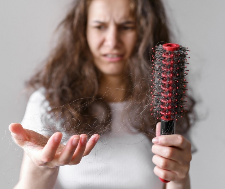  Comment prévenir ou guérir la chute de cheveux ?